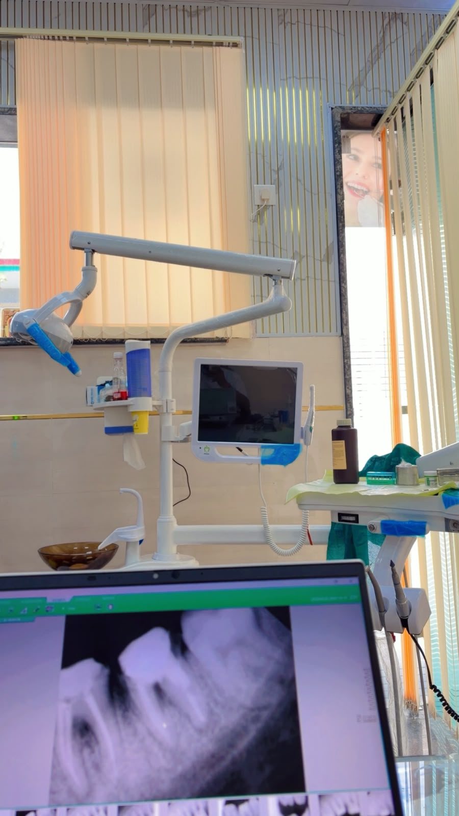 Digital X-ray viewed chair-side.