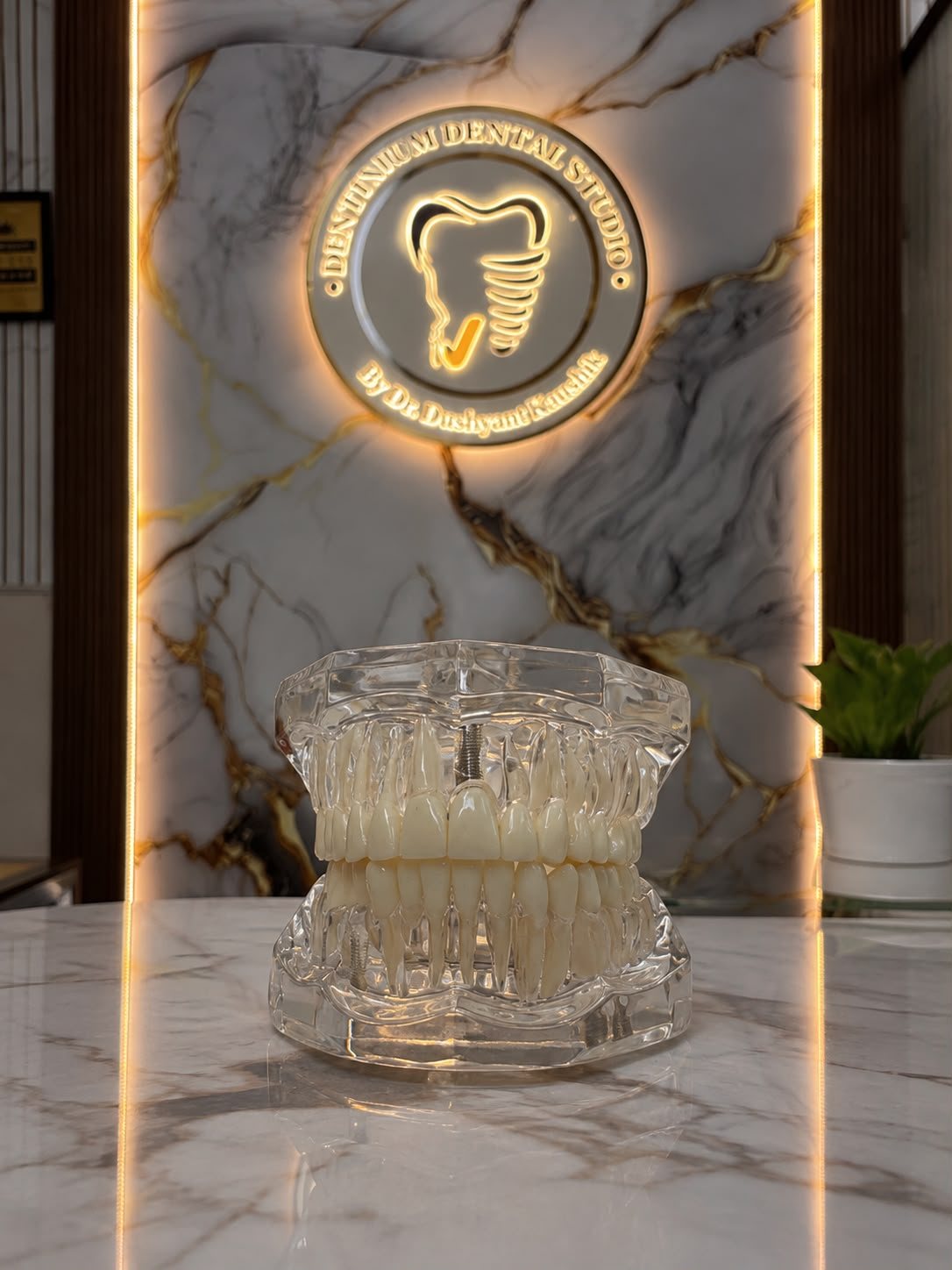Dental model showing implant placement at the clinic reception