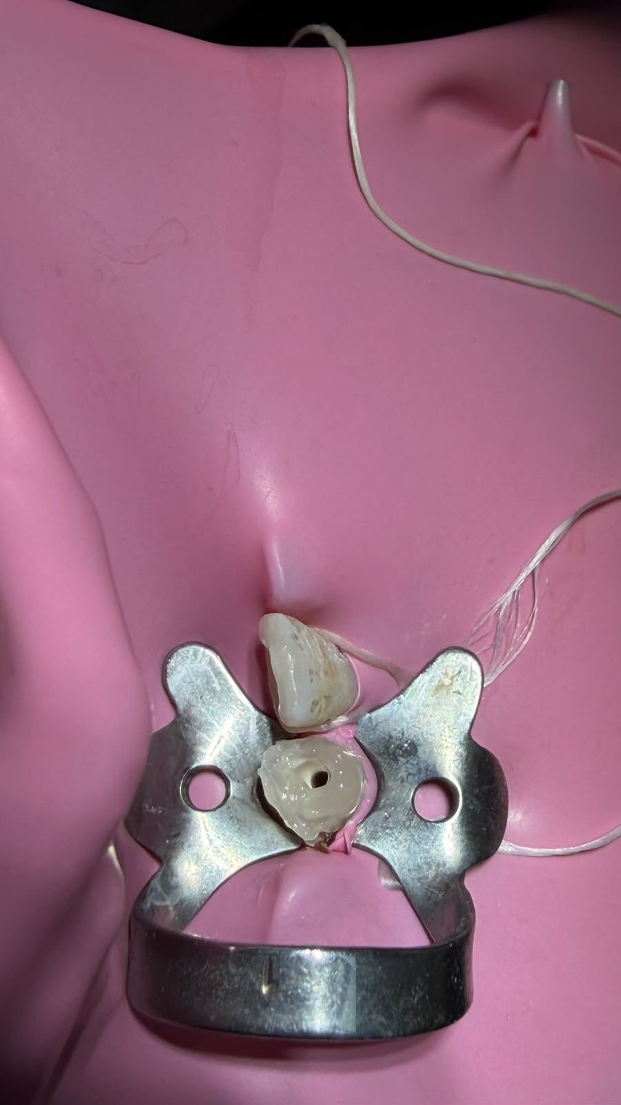 Rubber dam isolation during a root canal treatment at Dentinium Dental Studio